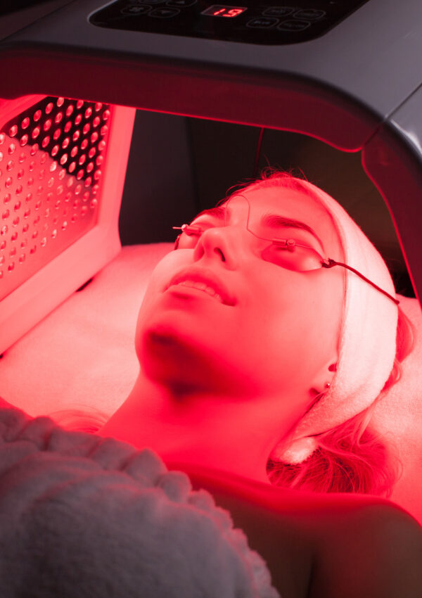 Red Light Therapy for Rosacea: Does it work?